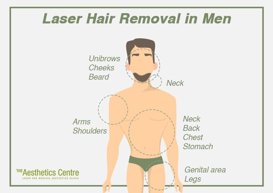 Laser Hair Removal for Men The Aesthetics Centre