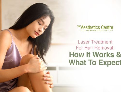 Laser Hair Removal 101 12 Facts You Need to Know